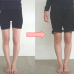 O脚はどのように歪んでいるのか？O脚矯正はどのように行うか？ ‐ 横須賀整体スタジオ｜背中のハリ・腰痛に効く整体院